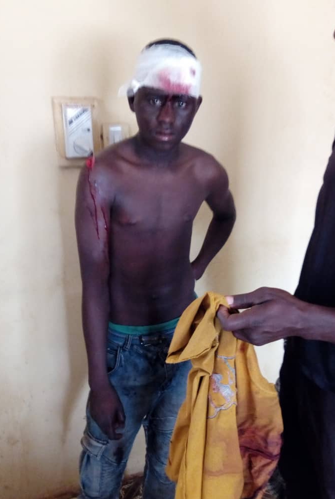 Fulani Herdsman Butchered in an attempt to rape.