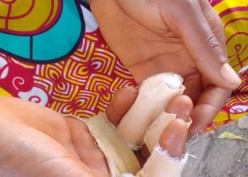 Husband inflicts deep cutlass wounds on wife at Don- Arayiri.