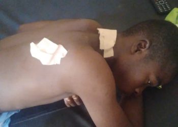 Bole- A commercial tricycle rider escaped death.