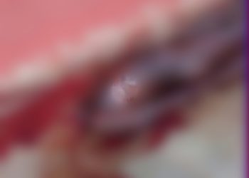 Horrific Murder At Bole, Man Beheaded, Private Part Missing.