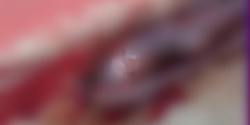 Horrific Murder At Bole, Man Beheaded, Private Part Missing.